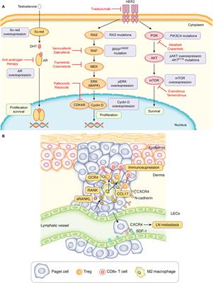 Metastatic Extramammary Paget’s Disease: Pathogenesis and Novel Therapeutic Approach